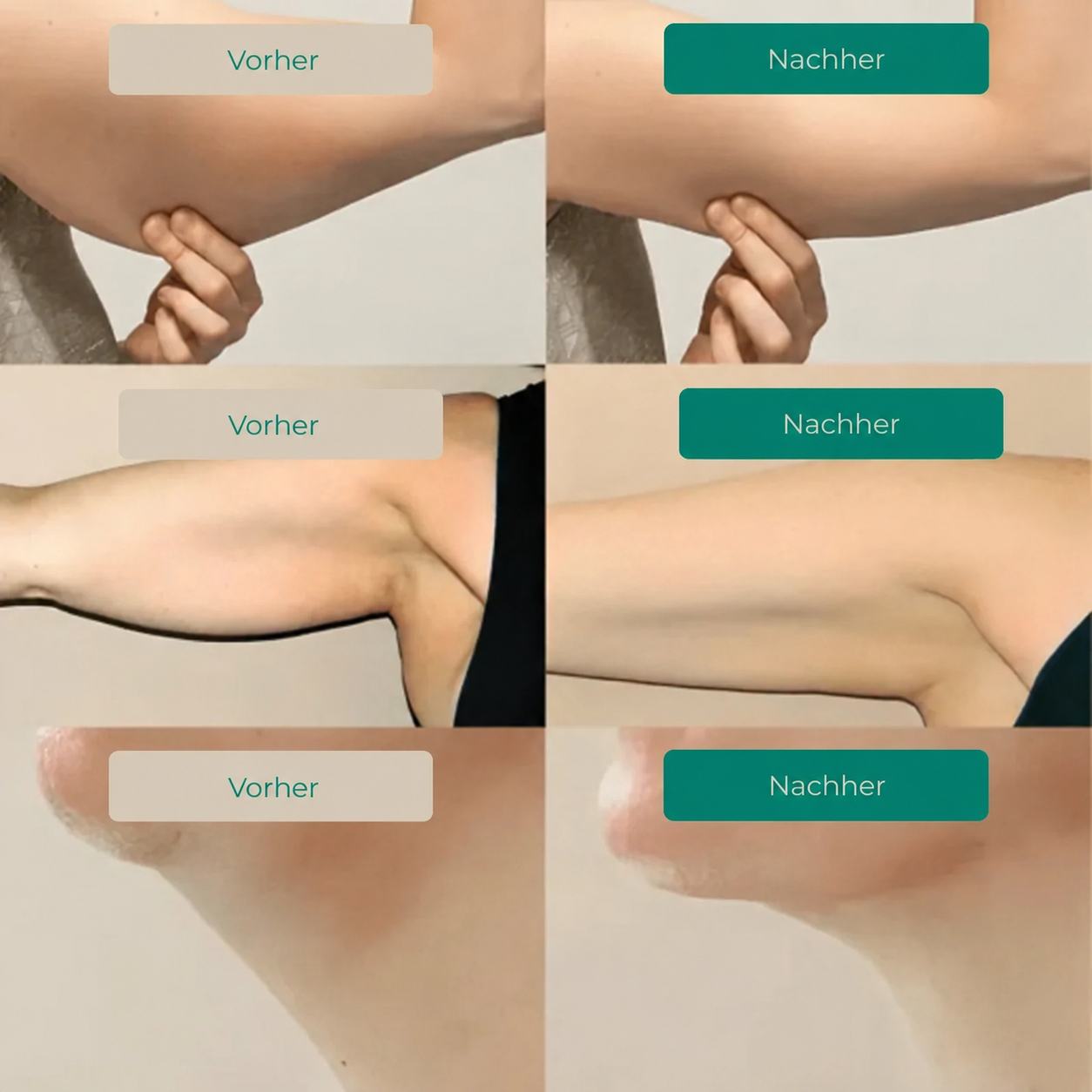 Lymphdrainage Komplex