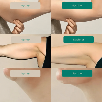 Lymphdrainage Komplex