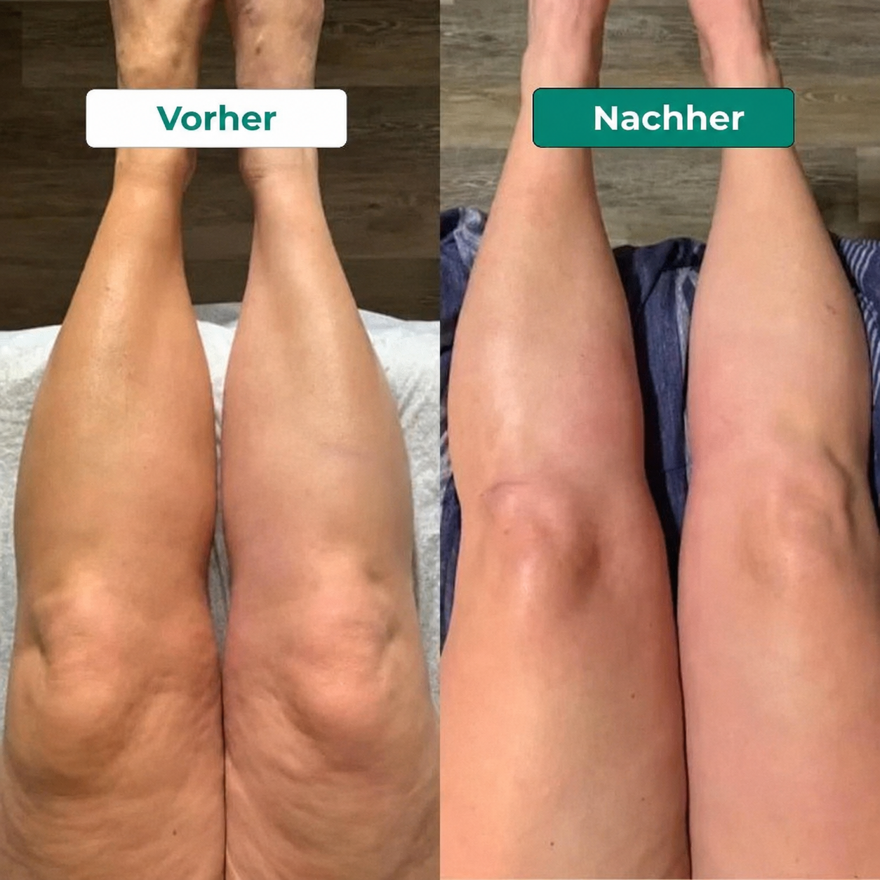 Lymphdrainage Komplex